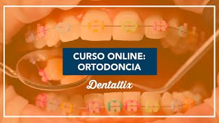 Curso online de ortodoncia La técnica del autoligado pasivo Universal Smile System [upl. by Johna]