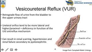 Vesicoureteral Reflux An Update [upl. by Anicart863]