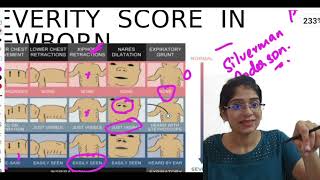 NEONATOLOGY PART 2  NEET PGFMGE  MALAYALAM [upl. by Assilana196]