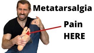 Strengthening Exercises for Metatarsalgia  Physical Therapy Treatment [upl. by Odnuges]