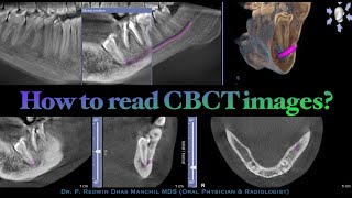 How to read CBCT images [upl. by Amyas644]