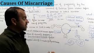 Causes of Miscarriage [upl. by Nnylram]