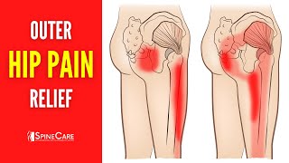 How to Fix Outer Hip Pain FOR GOOD [upl. by Oira]