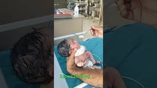 newbornbaby apgar spoonfeedingneonatalogy babyboy cute cutebabyneonatal firstfeeding [upl. by Norramic]