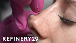 I Tried A NonSurgical Nose Job  Macro Beauty  Refinery29 [upl. by Oman]