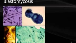 42 Systemic Mycoses [upl. by Mlohsihc]