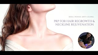 PRP For Hair Neck and Decolletage Rejuvenation [upl. by Irpak]