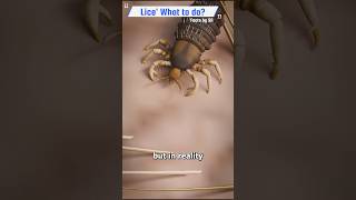 How Lice suck up blood Licelife headlice headlice [upl. by Phila866]