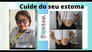 Aprenda a lidar com a sua colostomia [upl. by Annavas]