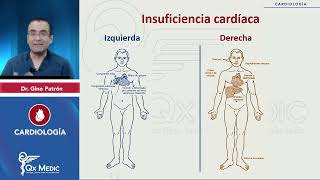 RM 2024 Cardio 5 INSUFICIENCIA CARDIACA PERICARDITIS AGUDA derrame pericárdico TAPONAMIENTO [upl. by Aicyle133]