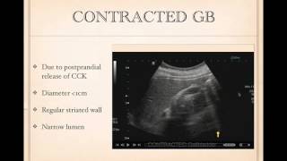 Tips for biliary ultrasound [upl. by Enirhtak]