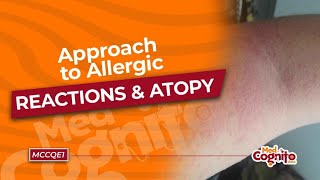 Approach to Allergic Reactions amp Atopy  MCCQE1 [upl. by Justicz99]