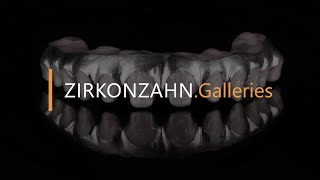 Prettau® 4 Anterior® zirconia on titanium  ZirkonzahnGalleries [upl. by Oiramej]