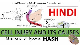 Cell Injury Hypoxia and Causes with Mnemonic in Hindi [upl. by Arze]