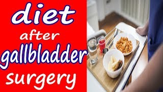 Diet after Gallbladder Surgery  Dos and Dont [upl. by Aisenet]