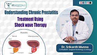 Understanding Chronic Prostatitis Treatment using Shock wave Therapy  health v9hospitals [upl. by Aldin]