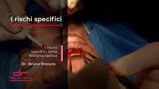 I RISCHI SPECIFICI dellIntervento di Blefaroplastica [upl. by Annav]