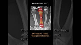 Descriptive terms example  Metacarpal Musculoskeletal Xray Quiz anatomy radiologychannel007 [upl. by Iaj]