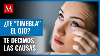 Mitos y verdades del virus del papiloma humano [upl. by Sproul]