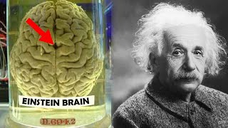 How Einsteins Brain was Different [upl. by Yelsa]