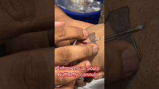 Butterfly cannulation  cannula cannulation trending ivtherapy SMpharmacy plz subscribe [upl. by Fonda]