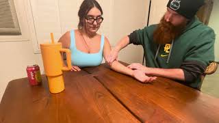 Wrist and hand joint palpation video [upl. by Yelsgnik]