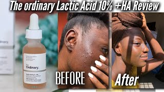 THE ORDINARY LACTIC ACID 10  HA  Indepth Review ♾ [upl. by Ybloc685]