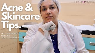 Acne Skin Care Tips by Dr Ashima Goel  Best Dermatologist In Chandigarh  HealthFinder [upl. by Nett]