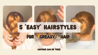 5 EASY hairstyles for GREASY hair  hair tutorial lazy girl hair greasy hairstyles [upl. by Euqnimod]