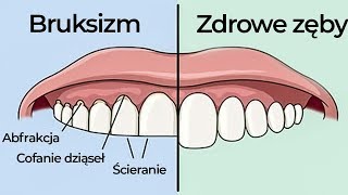 7 rzeczy których MUSISZ PRZESTRZEGAĆ aby przestać ZGRZYTAĆ ZĘBAMI [upl. by Derfnam]