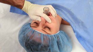 NuMask in Anesthesiology IntraOral Mask IOM®  Oropharyngeal Airway OPA Training Video [upl. by Rhona]