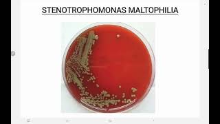 Stenotrophomonas maltophilia [upl. by Carita]