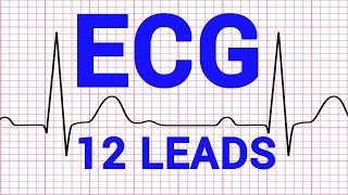 02 ECG  12 LEADS OF ECG  CARDIOVASCULAR PHYSIOLOGY [upl. by Aleira547]