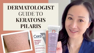 Dermatologist Guide to KP  Keratosis Pilaris Chicken Skin [upl. by Leora]