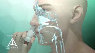 Fluticasone nasal spray Flonase  3D medical animation [upl. by Schober]