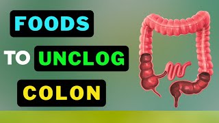 From Clogged to Clean Top Secret Colon Detoxifiers Revealed [upl. by Euqinay]