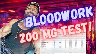 WHAT TO EXPECT ON 200 mg TESTOSTERONE per week  Bloodwork and How I feel after 4 months on 200mg [upl. by Kirsti606]