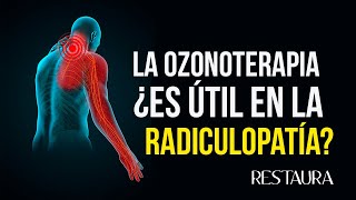 La ozonoterapia ¿Es útil en radiculopatía [upl. by Auhsot]