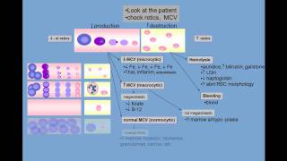 Anemia differential diagnosis [upl. by Kimitri108]