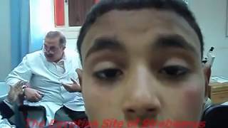 Chronic Progressive External Ophthalmoplegia  شلل عضلات العين [upl. by Araldo]