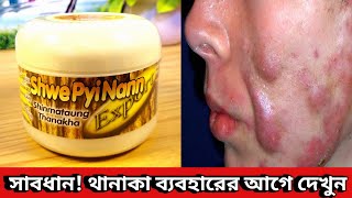 Thanaka Face Pack Review  মিয়ানমারের থানাকা ব্যবহার করে কেমন রেজাল্ট পেলাম Thanka Facepack [upl. by Arraet161]