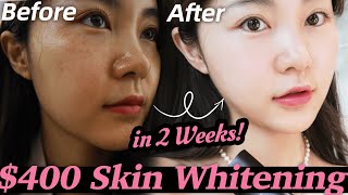 REAL EXPERIENCE kpop idols whitening treatment Unexpected results 🤯  Lyn Beauty [upl. by Stambaugh528]