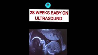 28 weeks baby on ultrasound pregnant ultrasound pregnancare [upl. by Noll]