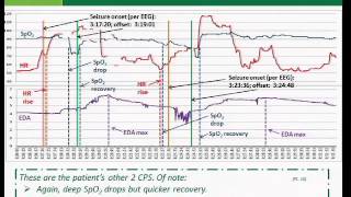 An extracerebral biosignal pattern for epileptic seizure detection [upl. by Tchao]