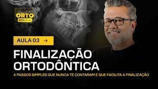 Aula 39  Finalização Ortodôntica [upl. by Tloc]