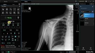 Introduction to Rayence Xmaru Pro Xray Console [upl. by Pember]