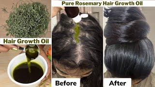 I used👆🏼this Rosemary Hair Growth Oil on Thinning Hair amp Bald ScalpGot 10 times Thick Hair Growth [upl. by Aicala289]