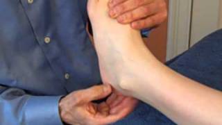 Calcaneofibular Ligament Fascial Separation [upl. by Thadeus791]