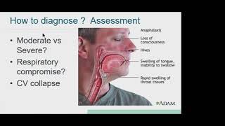 05 Contrast Induced Anaphylactoid Reaction [upl. by Laaspere224]