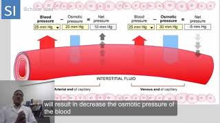 Hydrostatic pressure Vs Oncotic pressure  made easy [upl. by Kyriako]